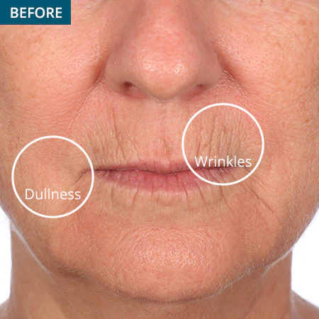 45-Day Face & 30-Day Eye Boot Camp Challenge - Image 4