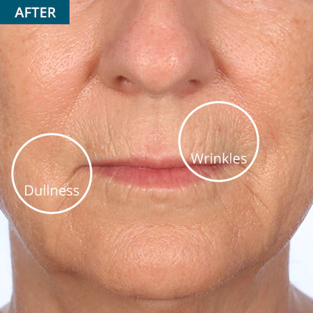 45-Day Face & 30-Day Eye Boot Camp Challenge - Image 5