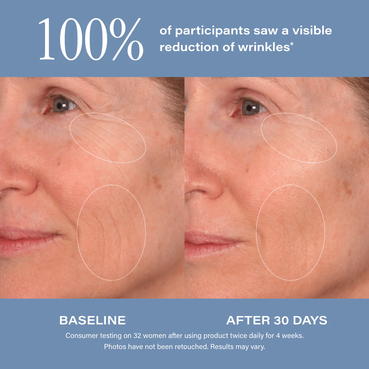 Age Reset Serum Intensive - Image 3