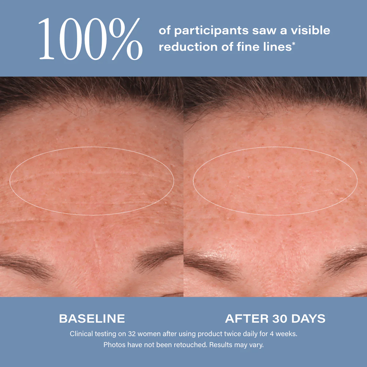 Age Reset Serum Intensive - Image 8