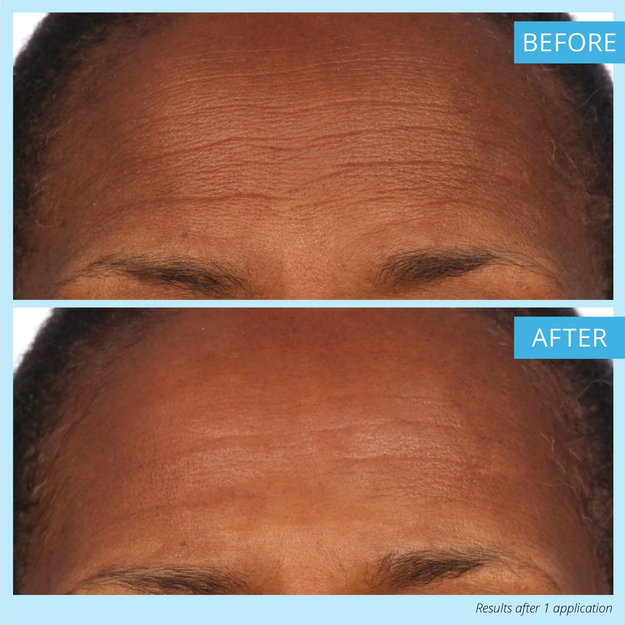 Dermappeal® Trial Offer - 20% OFF - Image 7