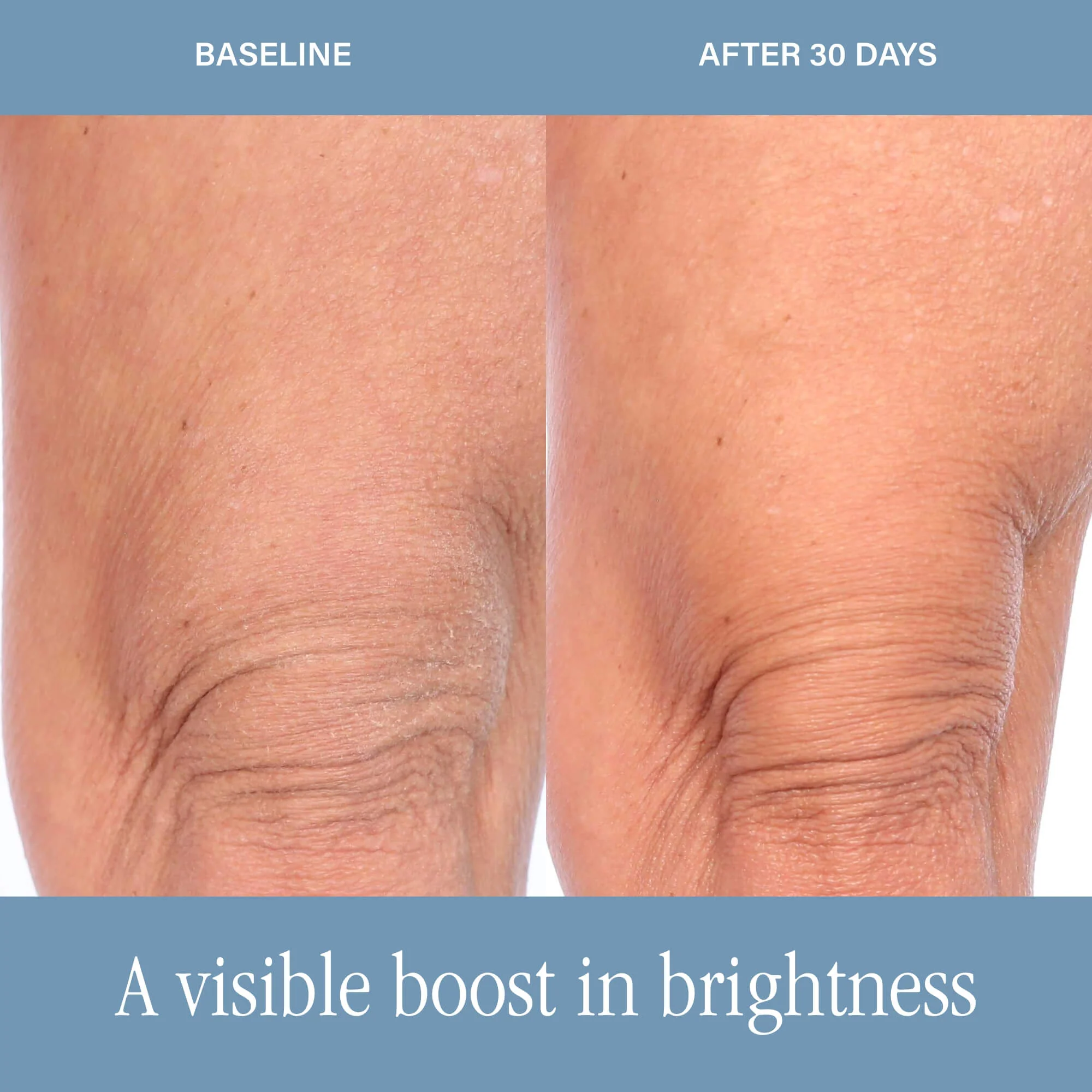 DermAppeal® Body - Image 6