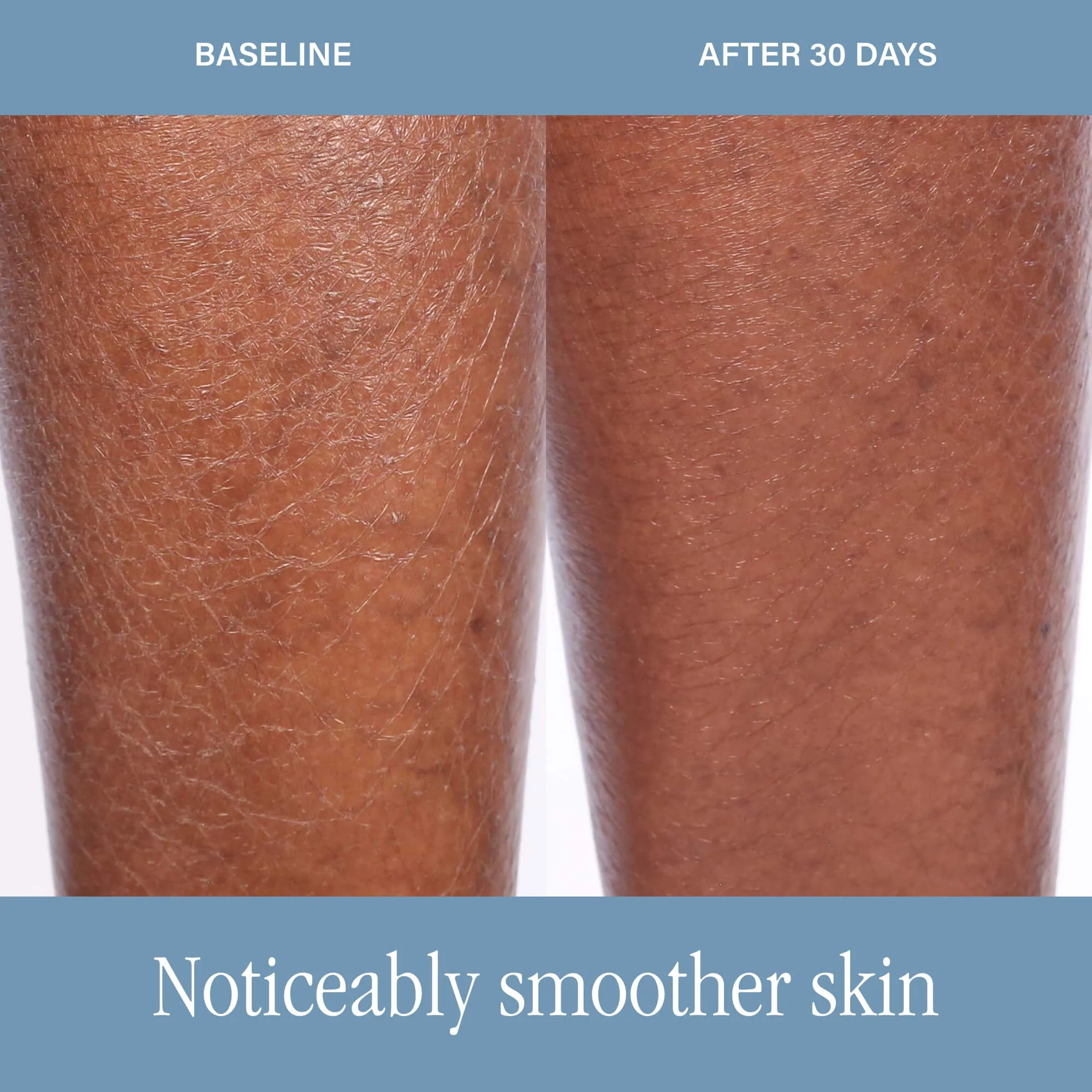 DermAppeal® Body - Image 7