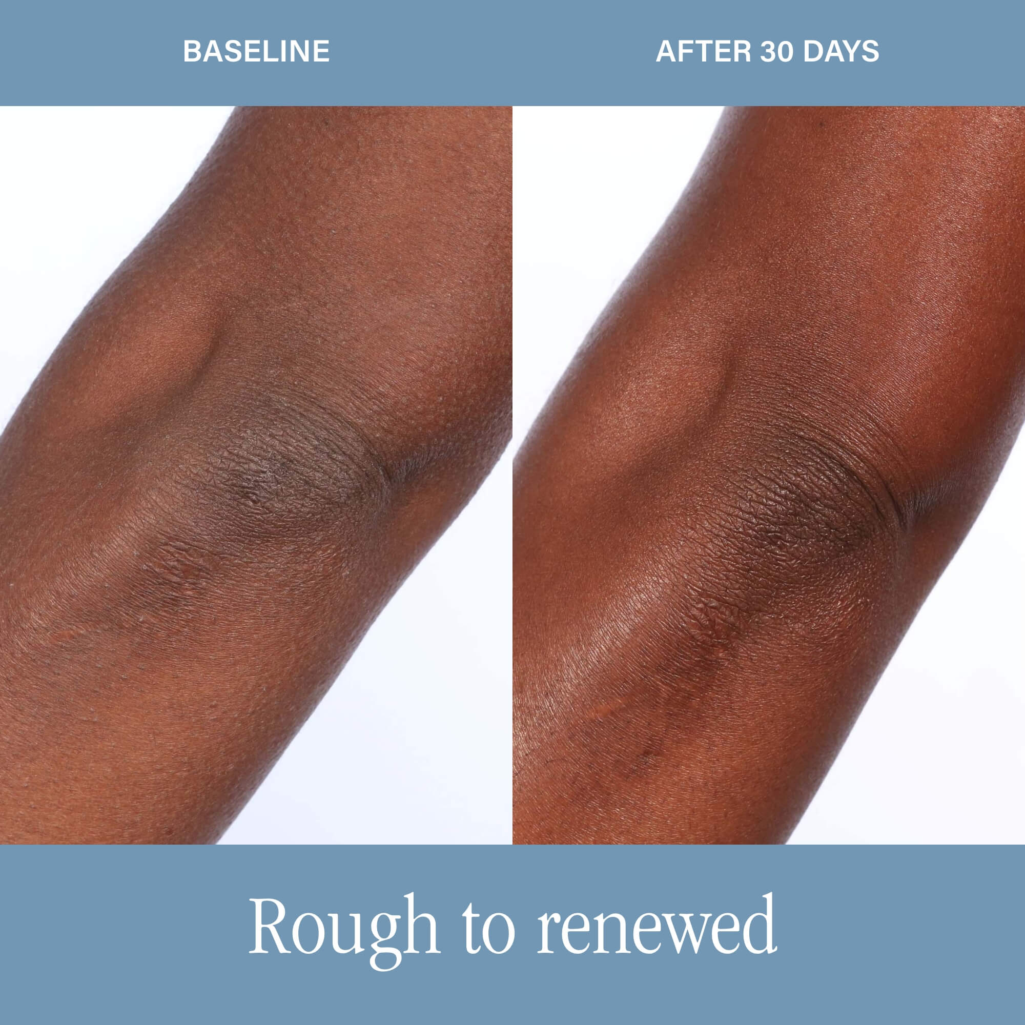DermAppeal® Body - Image 8