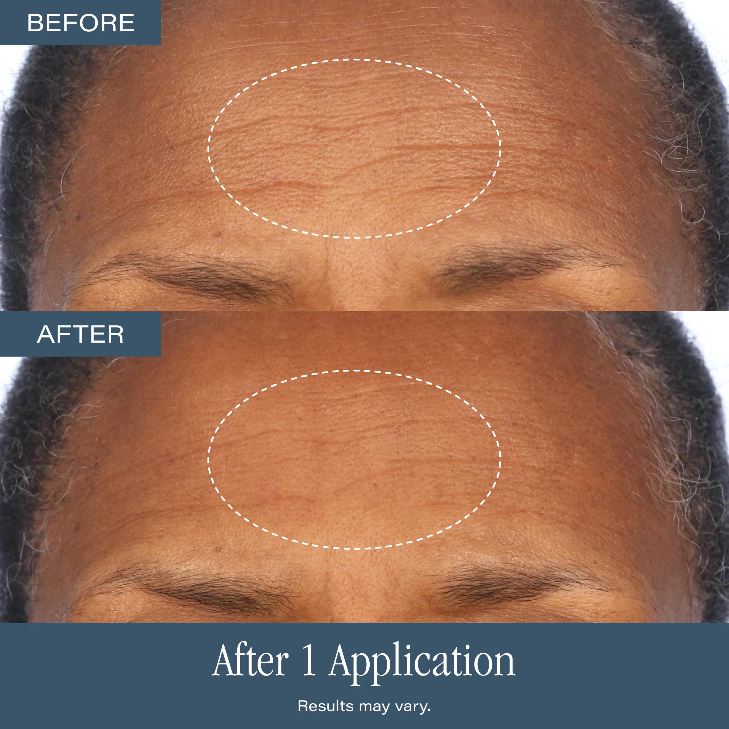 Skip the Derm Duo - Image 4